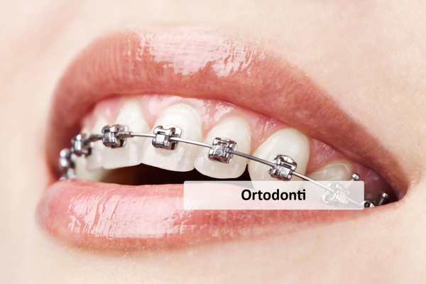 Ortodonti