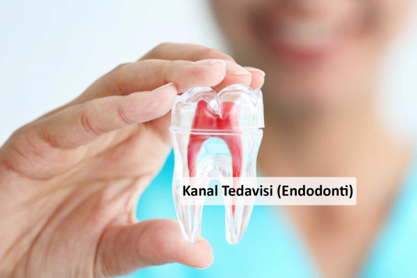 Kanal Tedavisi (Endodonti)